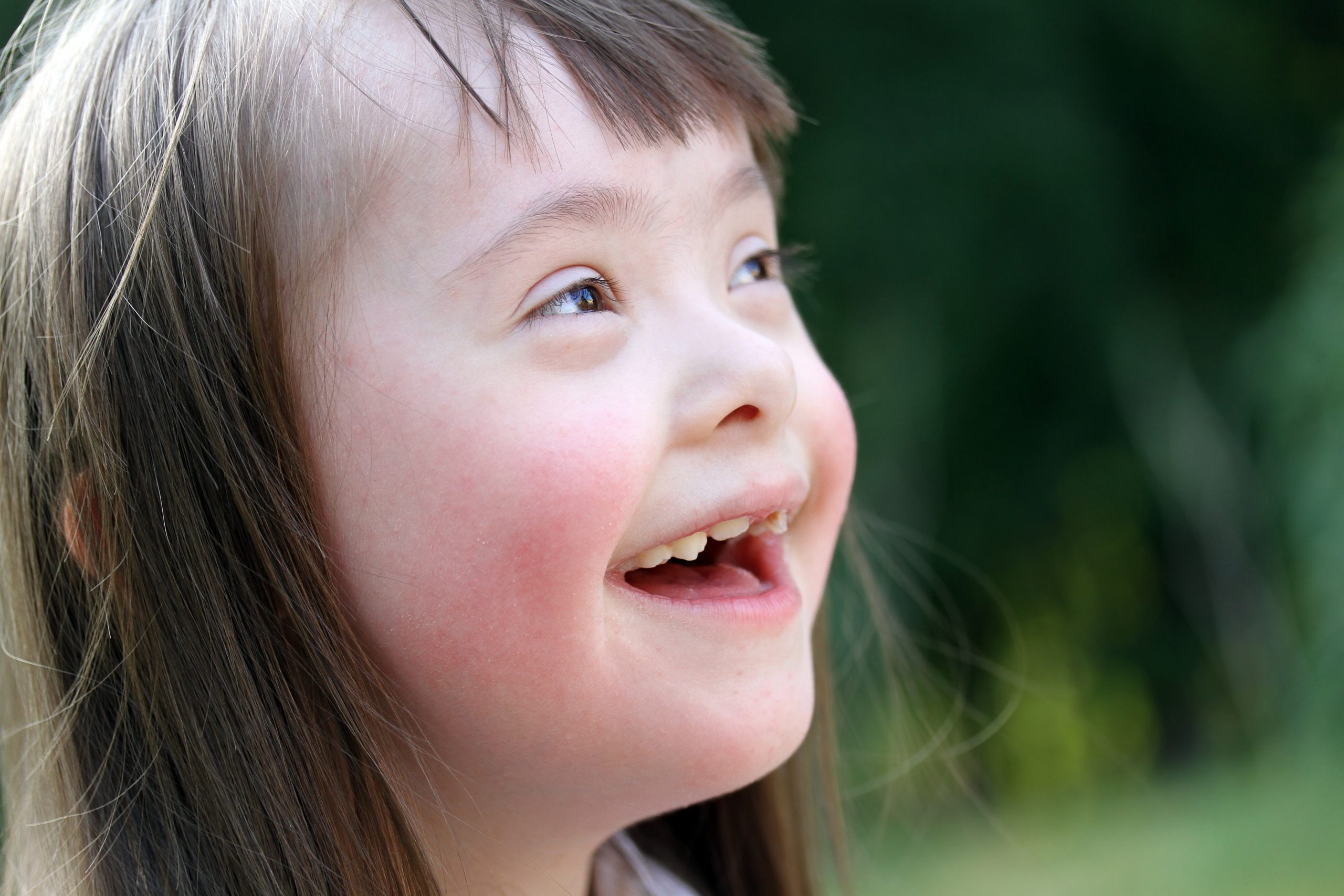 Portrait of beautiful young girl with down syndrome
